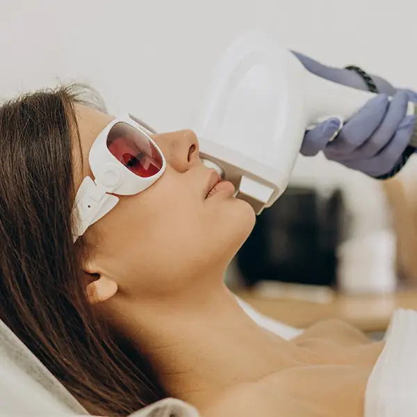 Laser IPL or Photofacial for Dark Spots