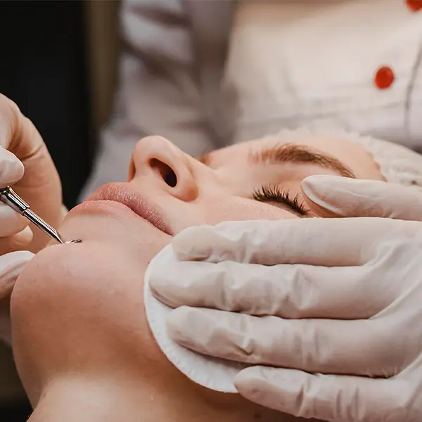 Wart and Skin Tags Removal​